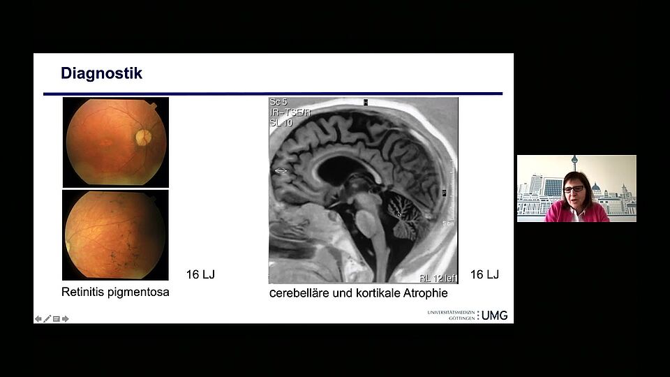 Demenzerkrankungen bei Kindern und Jugendlichen